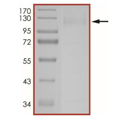 The purity of nCoV-S1 (K417N, E484K, N501Y, D614G) was determined to be >90% by densitometry
